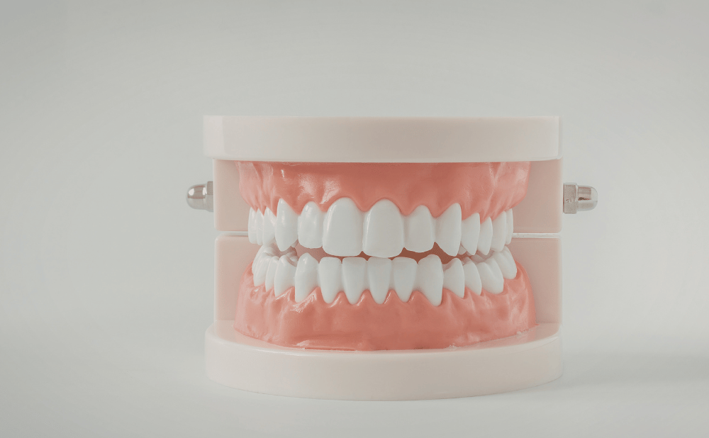 歯列矯正5年かかるのは異常？