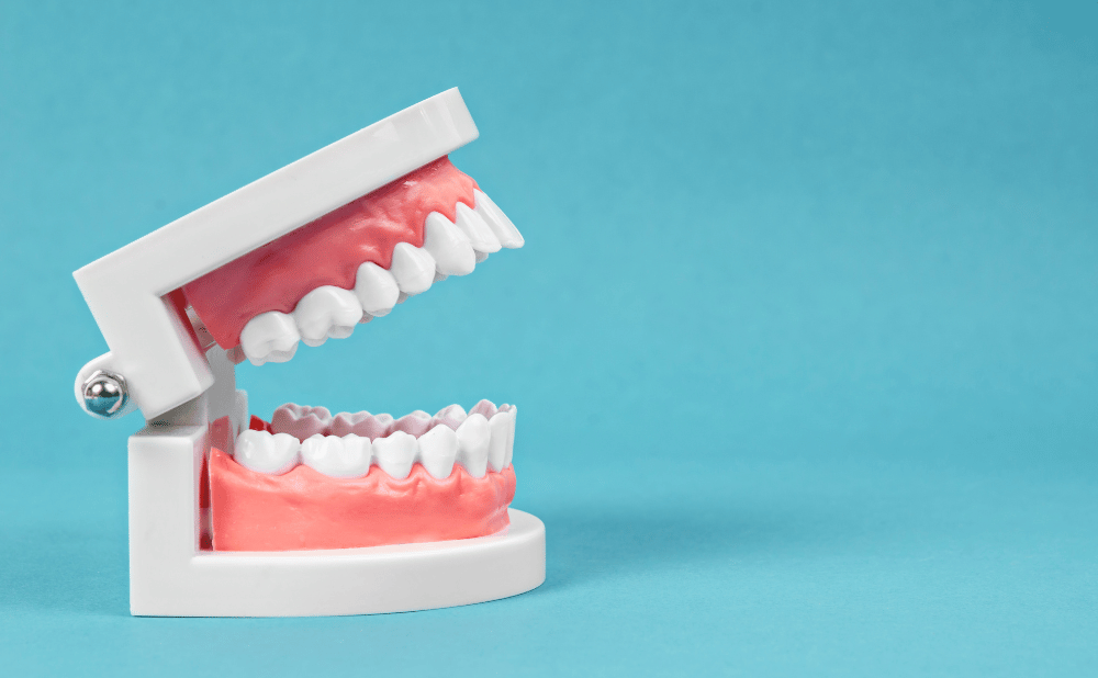 オールオンフォーと総入れ歯の違いについて