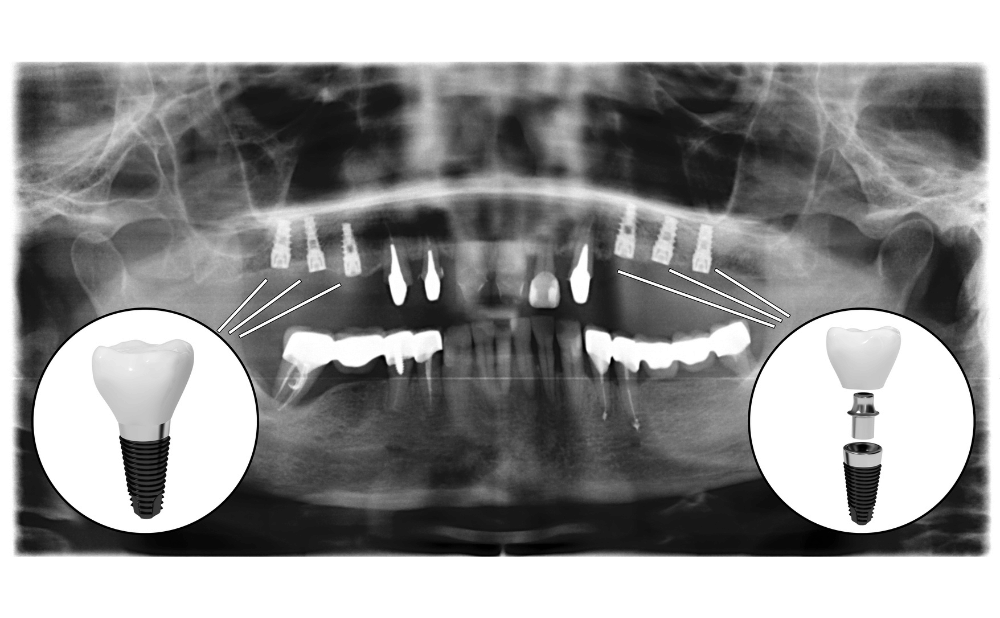 オールオンフォーのメリット・デメリット