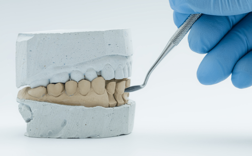 歯列矯正で可愛くなる人の特徴