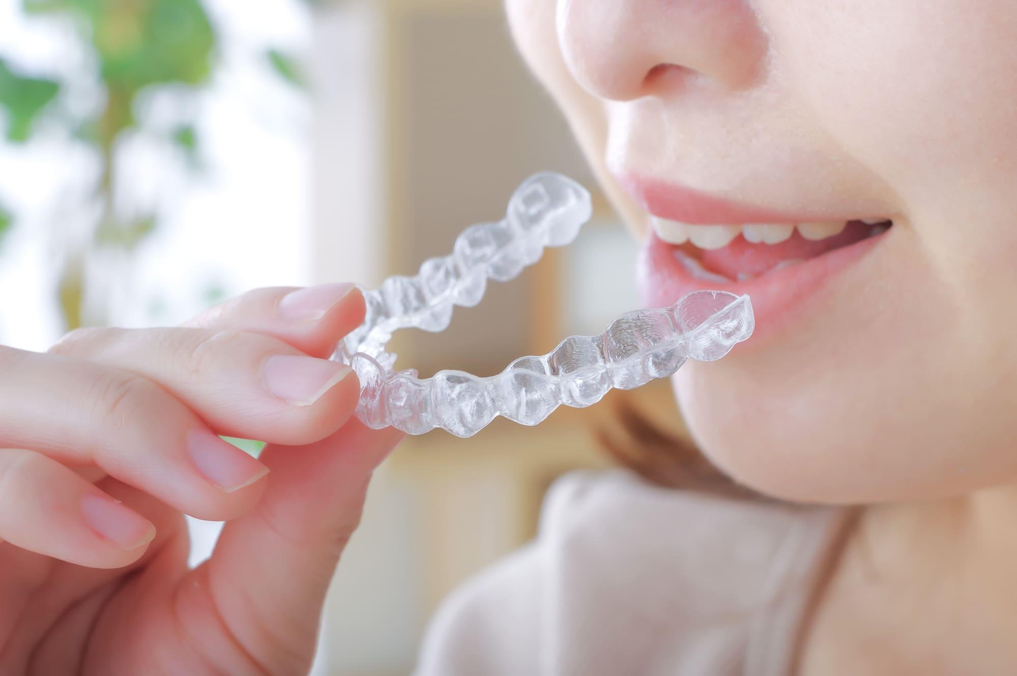 口ゴボはマウスピース矯正で改善できる？費用や期間、注意点を徹底解説