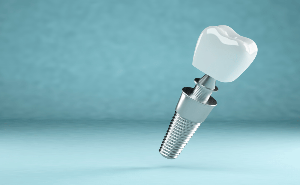 下呂市からインプラント治療を検討している方へメッセージ